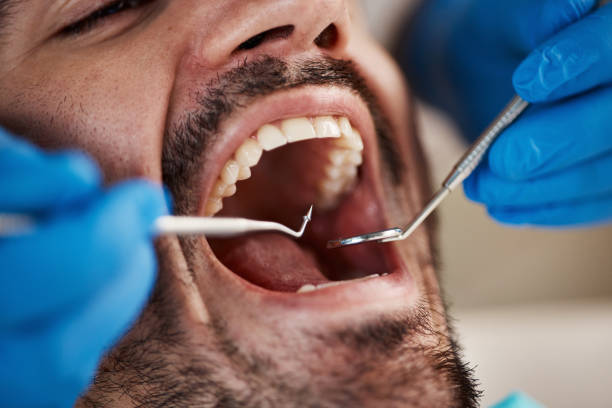 Best Emergency Treatment for Toothache in Mcnary, AZ