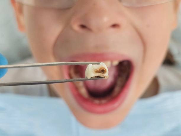 Best Weekend Emergency Dentist in Mcnary, AZ